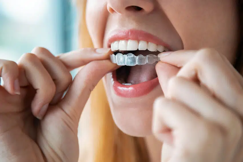 Invisalign Dentist Newport Beach