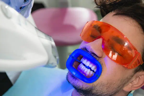 Zoom Teeth Whitening Treatment