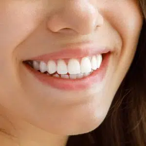 Female smiling with healthy teeth