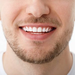 smile-young-man-closeup-result-teeth-whitening