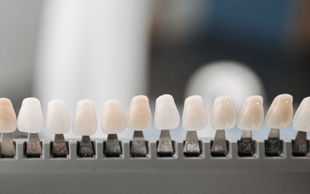 Benefits-of-Veneers-1