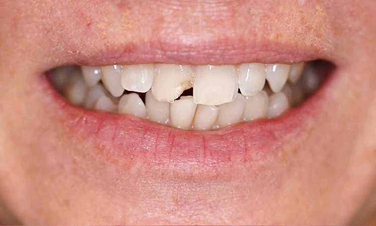Emergency Dentist