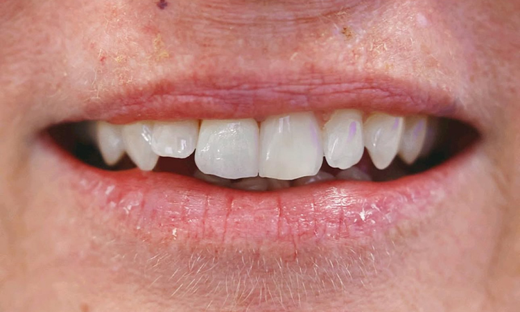 Emergency Dentist