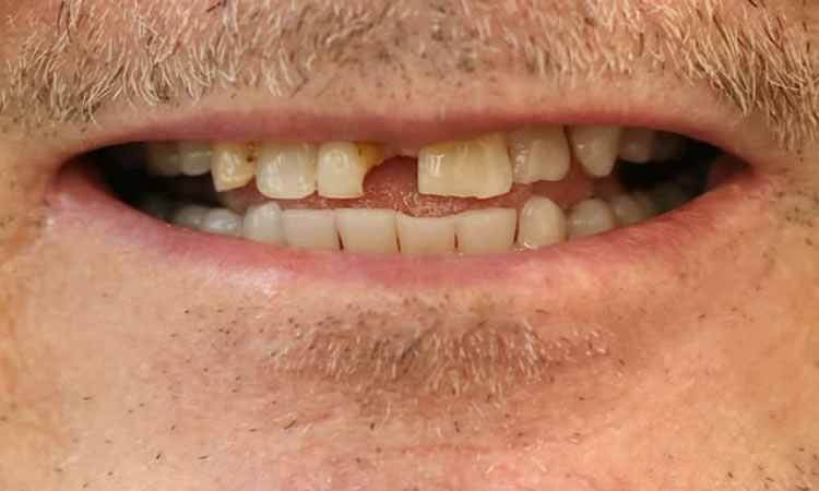 Emergency Dentist