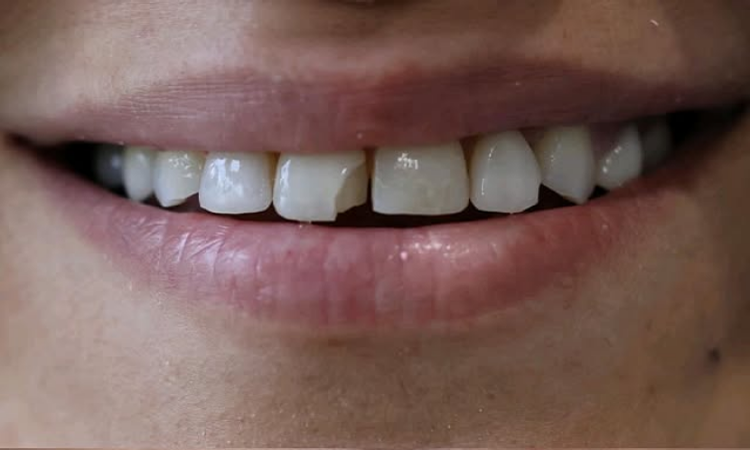 Emergency Dentist