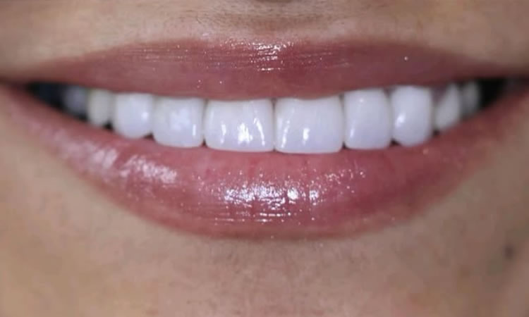Emergency Dentist