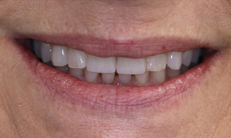 Emergency Dentist