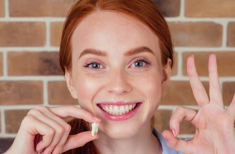 wisdom teeth extraction — featured image