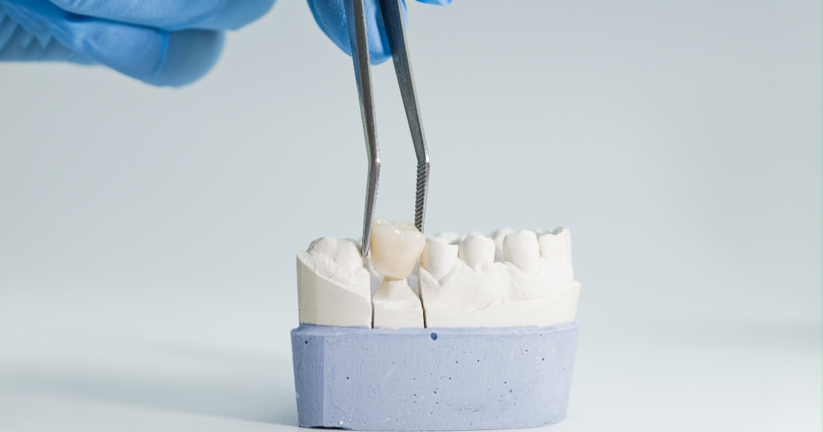 how much is a crown without insurance — featured image